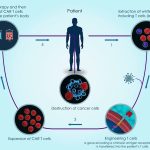 Advancements in Cancer Treatment: What’s New in 2025